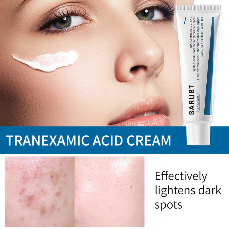 Tranexamic Acid Cream for Chloasma and Moisturizing