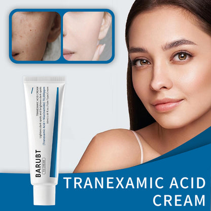 Tranexamic Acid Cream for Chloasma and Moisturizing