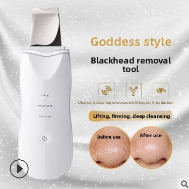 Ultrasonic Skin Peeling Cleansing Device
