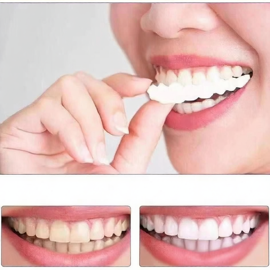 Upper and lower teeth simulation braces