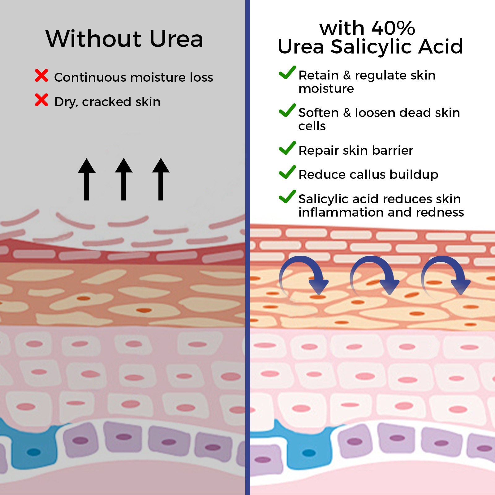 Urea Cream