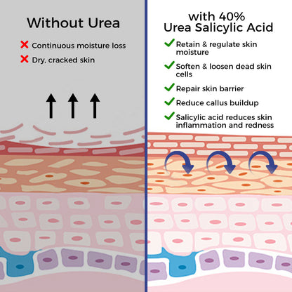 Urea Cream