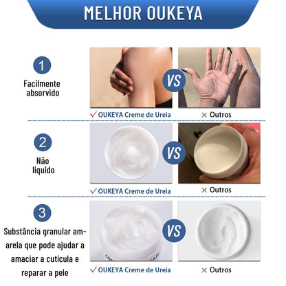 Urea Cream