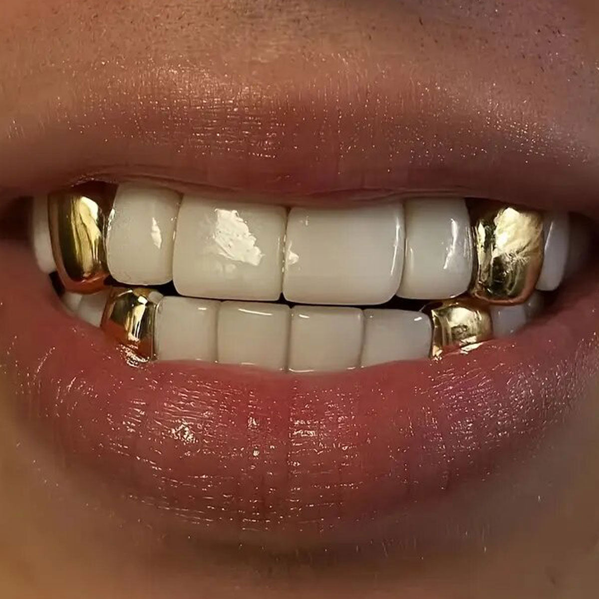 Vampire Fang Braces