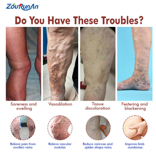 Vein Relief Cream