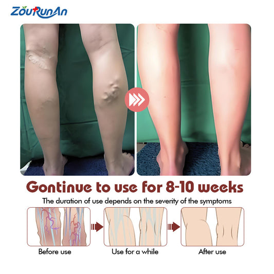 Vein Relief Cream