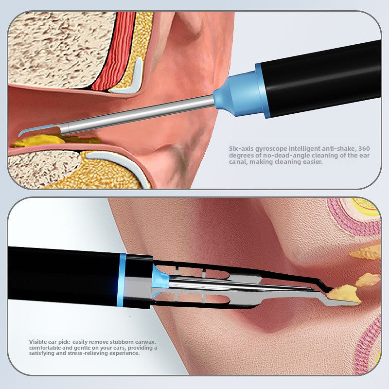 Visual ear pick