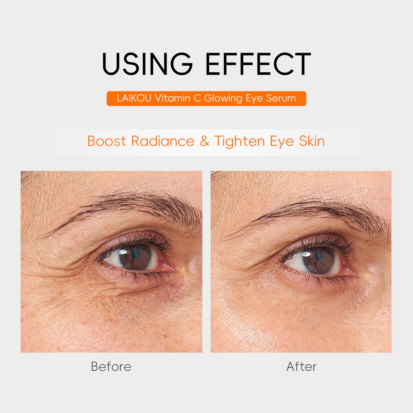 Vitamin C Eye Essence 30ml Eye Care Treatment