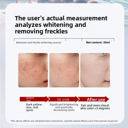 Whitening essence