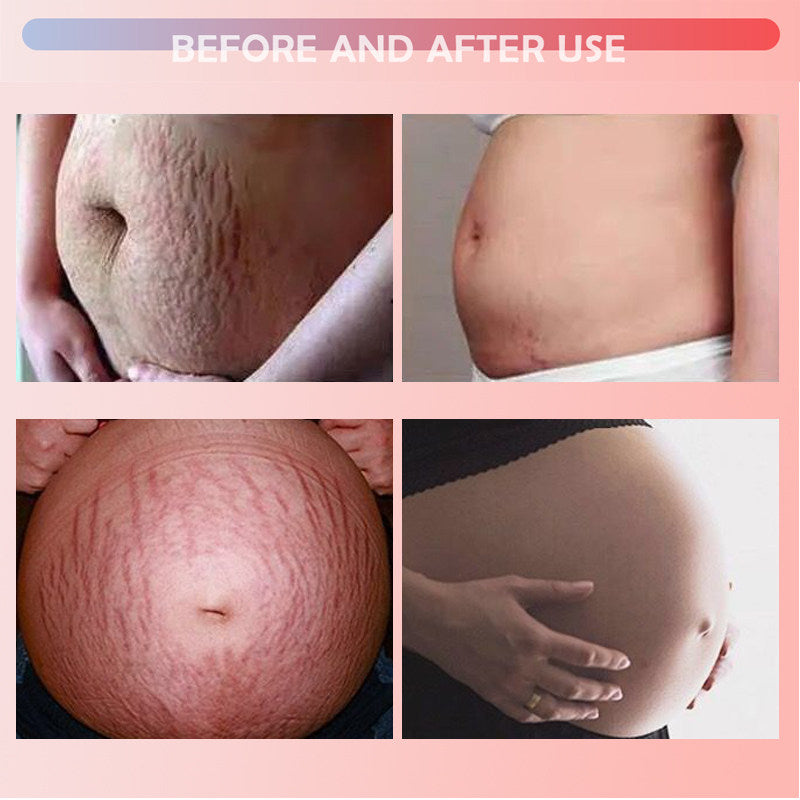 Wrinkle-Removal Cream