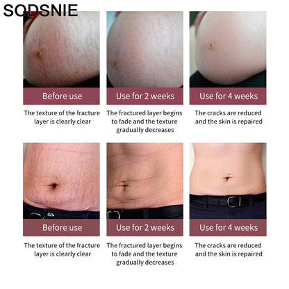 Wrinkle-Removal Cream